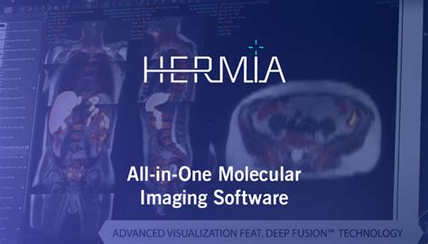 Hermes mri software